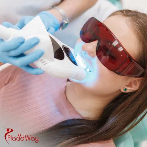 Teeth Whitening in Turkey: A Safe and Effective Option for German Tourists Seeking a Brighter Smile